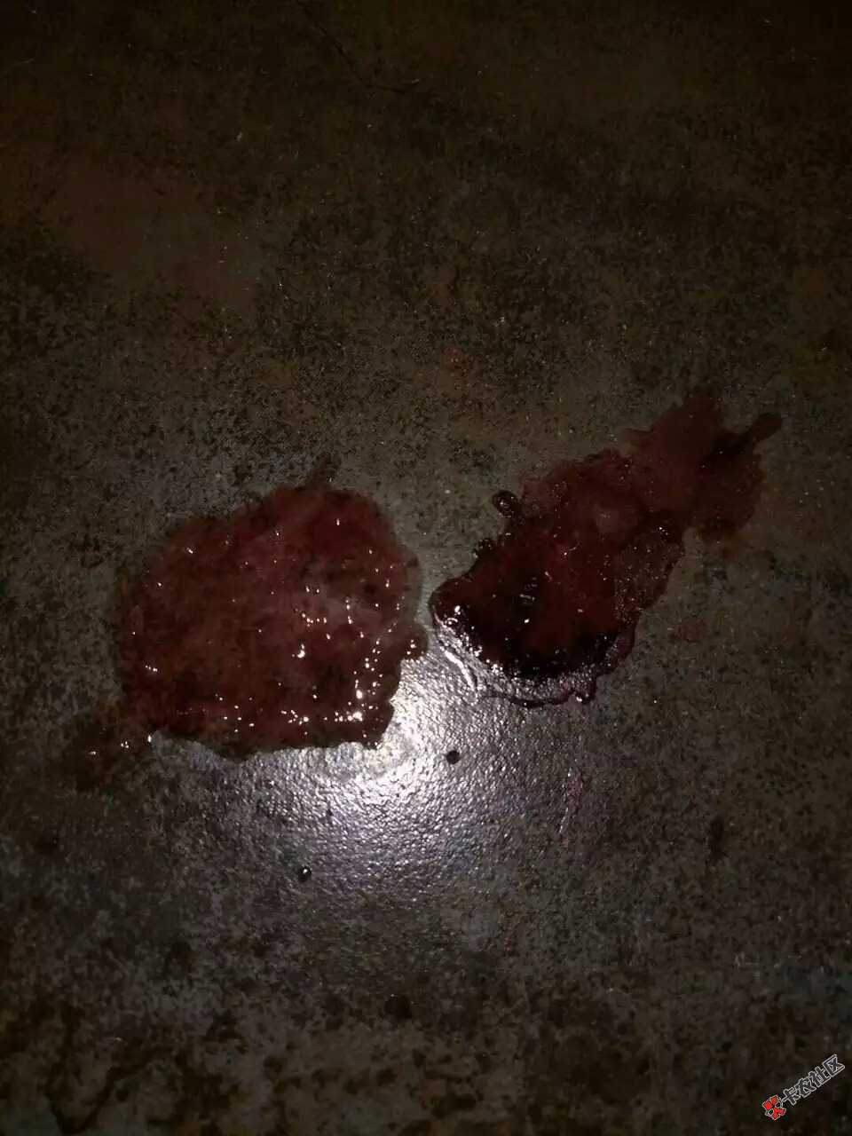 :上次医生跟我说如果继续坚持不治疗，如果肺大出血我就分分钟结束了。。。 ...18 / 作者:北海道的风景 / 